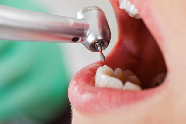 Best Emergency Treatment for Dental Infections or Abscesses in Somerset, KY